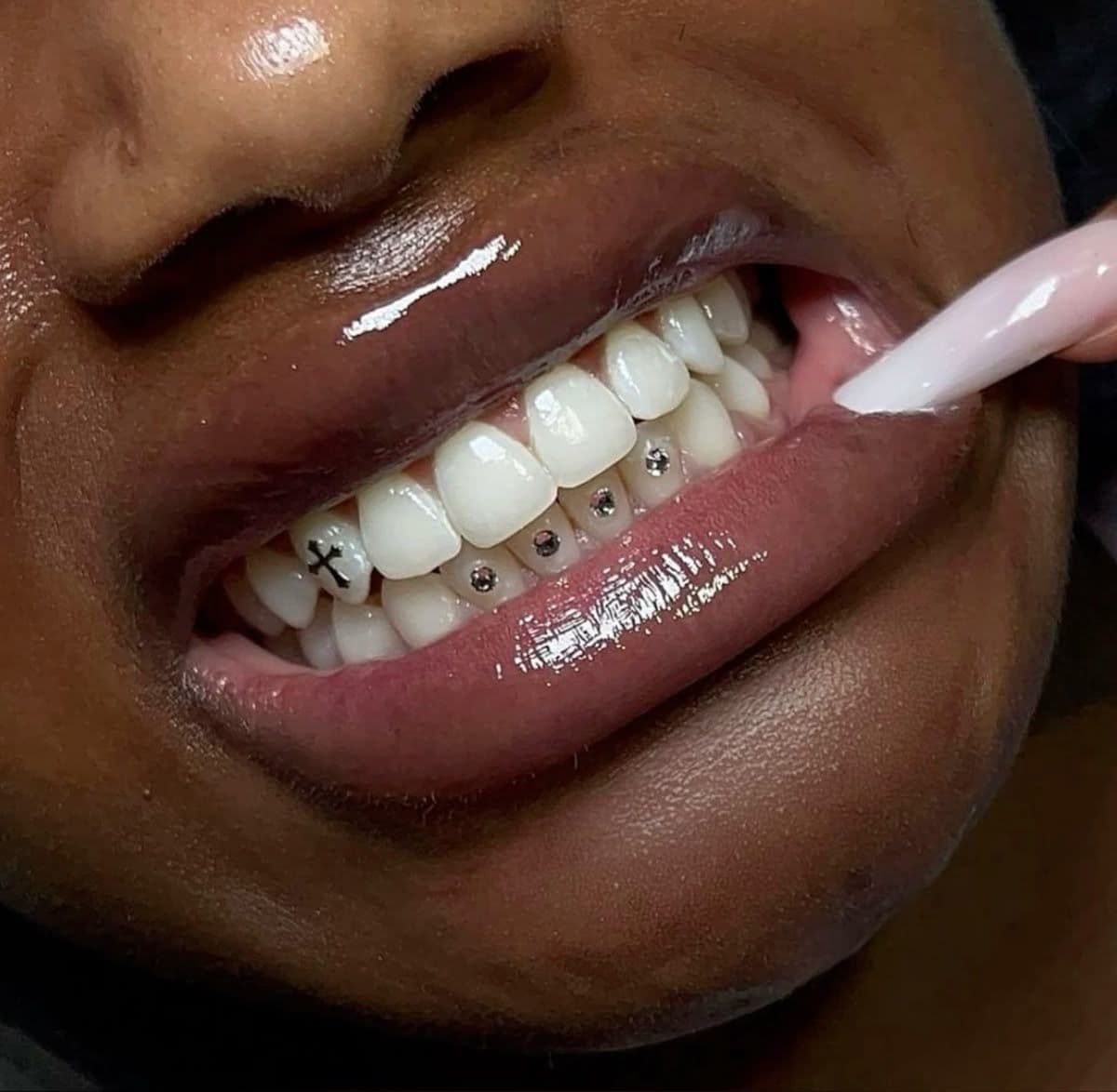 Tooth Gem